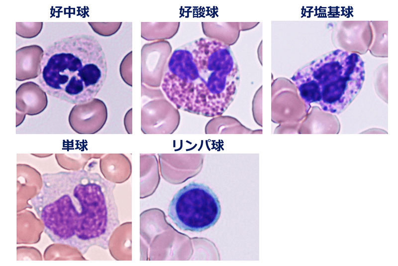 5種類の白血球