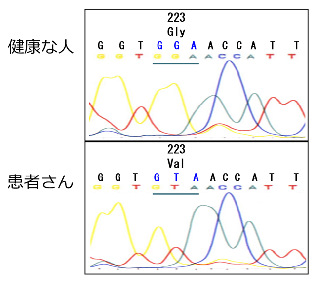 第X因子遺伝子のDNAシークエンシング
